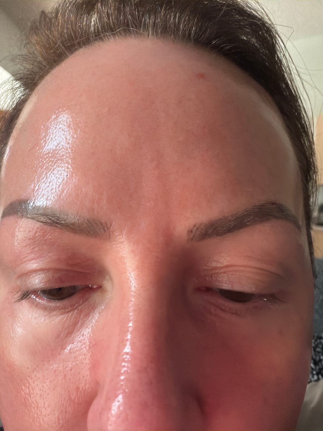Customer photo review of Skin Peel & Growth Factor Serum Bundle
