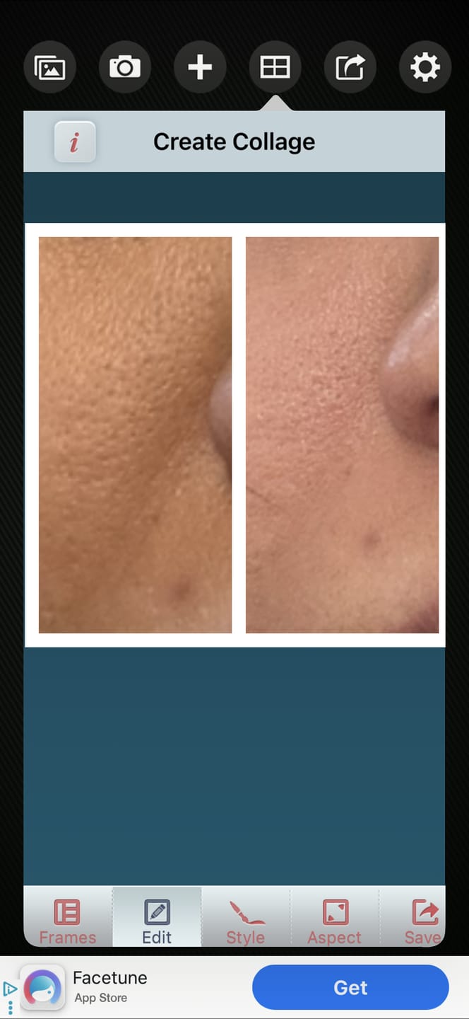 Customer photo review of Ujvala Skin Brightening Moisturizer