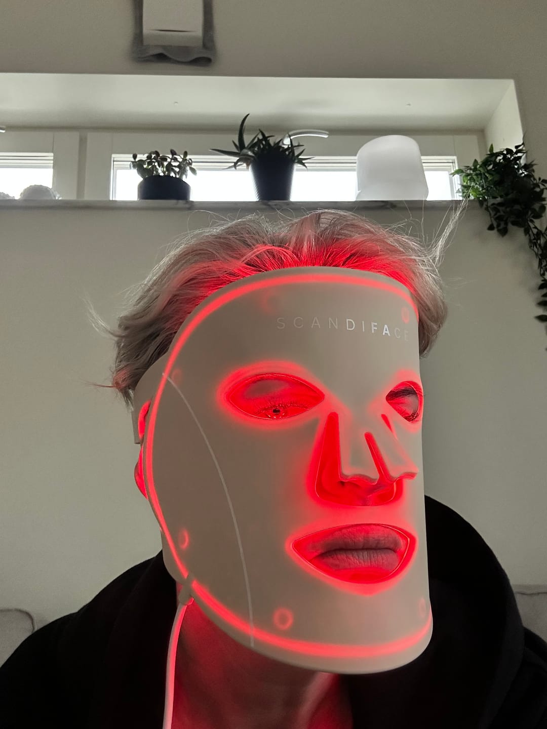 Customer photo review of Skinboosting LED mask