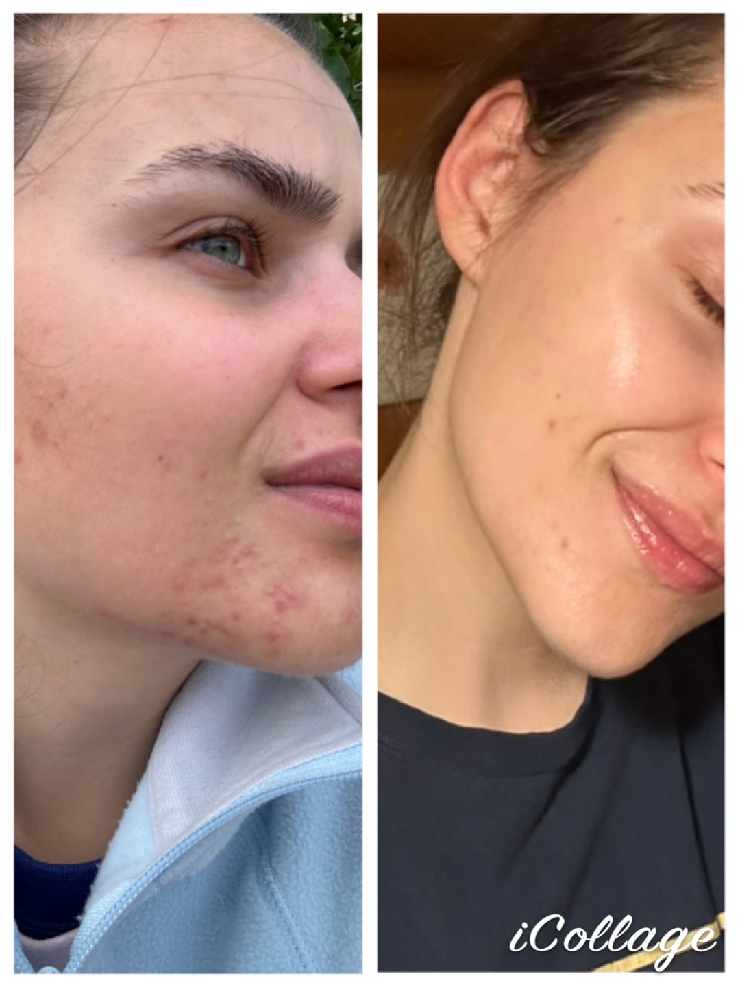 Customer photo review of Crema cu Retinol
