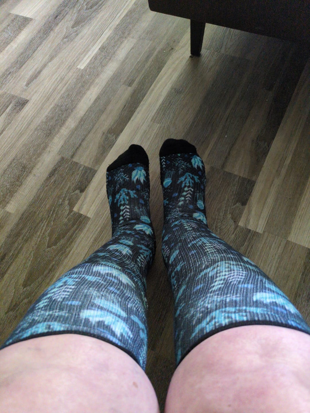 Customer photo review of Compression Socks | Bundle