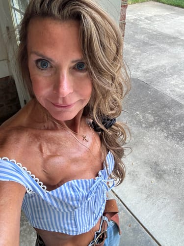 Customer selfie showing her face and skin after using the Seranova Micro Infusion System.