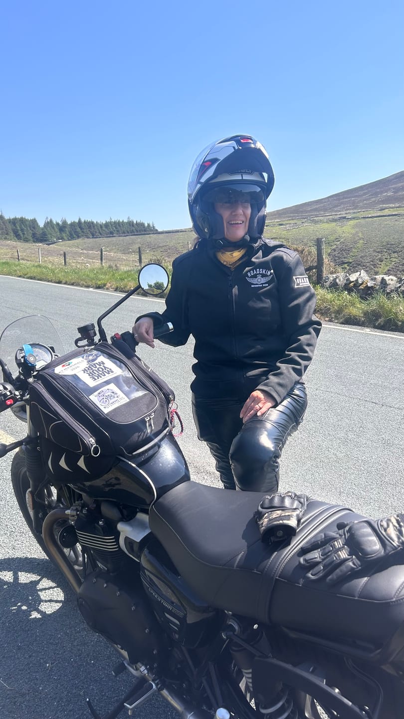 Customer photo review of Roadskin® Motorcycle Hoodie & Shirt Shoulder Armour (Pair)