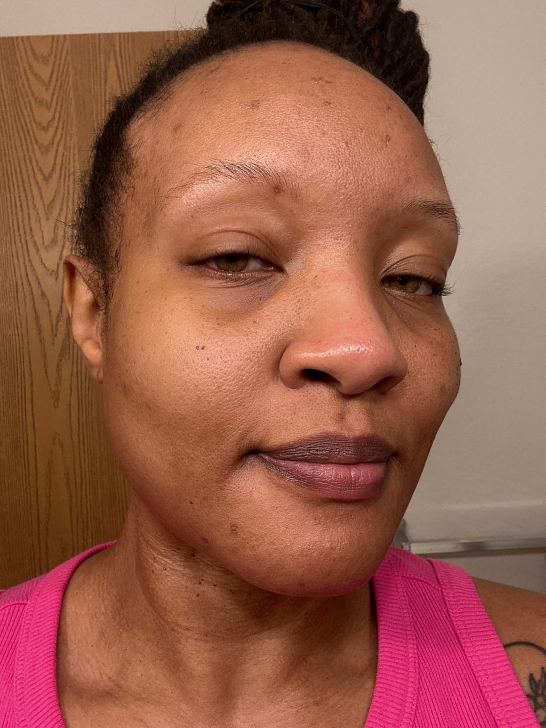 Customer photo review of LIMITED EDITION: Jolie’s Mini Full Body & Face Brightening Kit/ Acne Kit