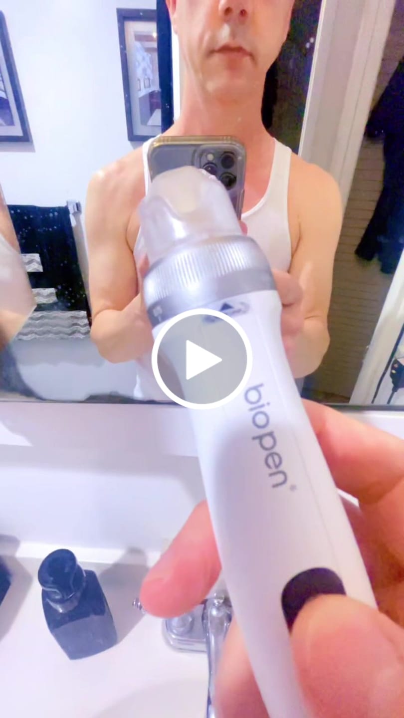 Customer video review of Bio Pen Q2 Replacement Cartridges