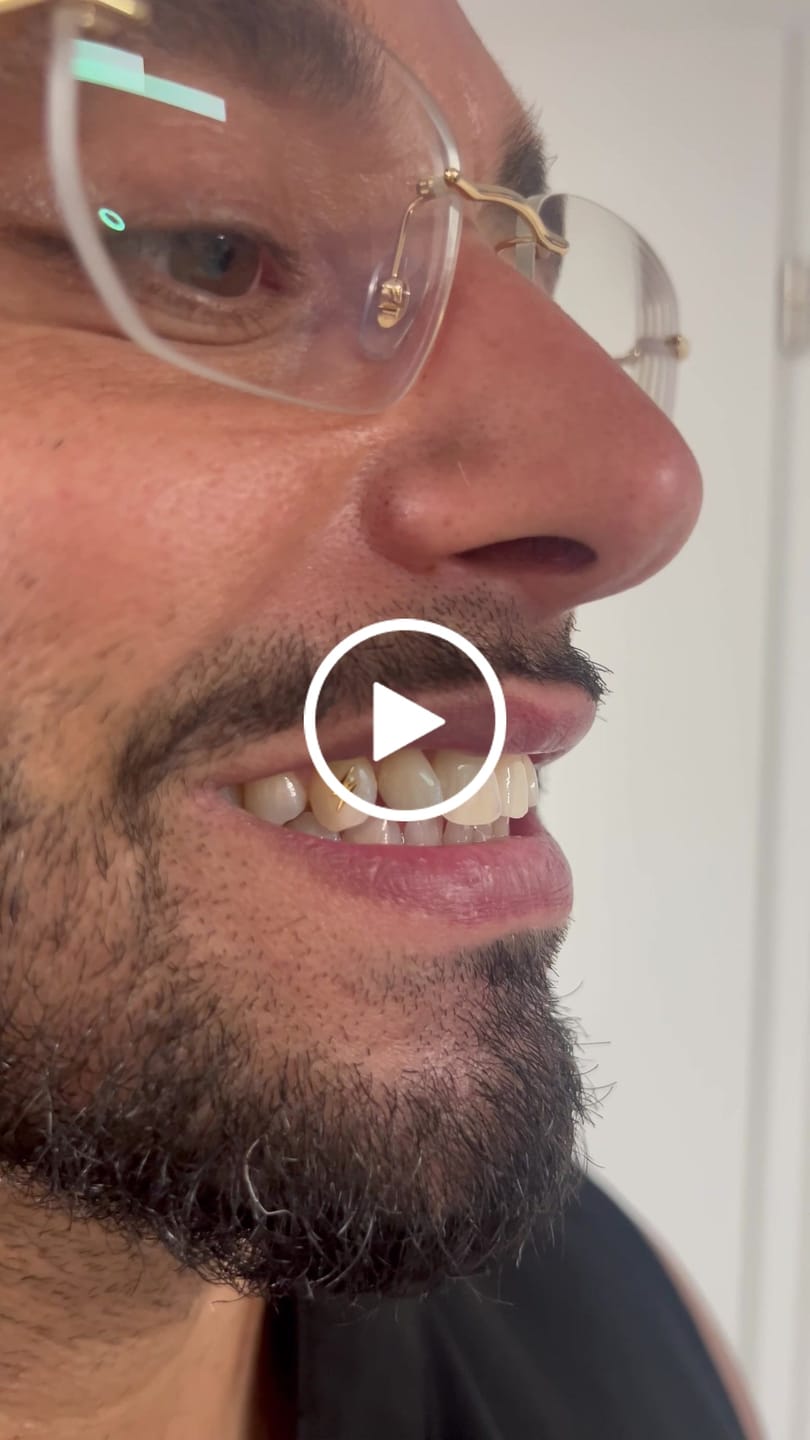 Customer video review of Bolt 22-karat gold