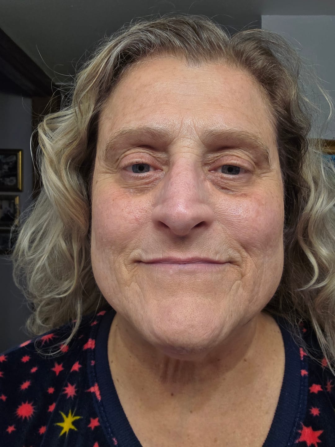 Customer photo review of 3 Month Supply - Deep Collagen Cream