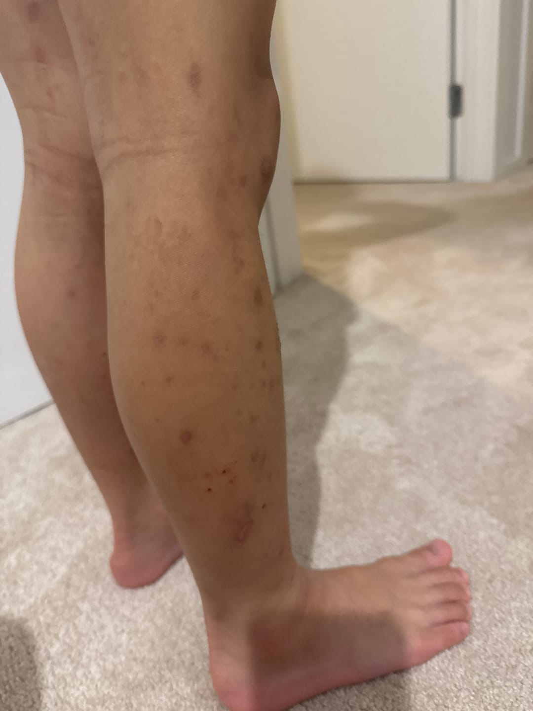 Customer photo review of Hemp Seed Rescue Butter