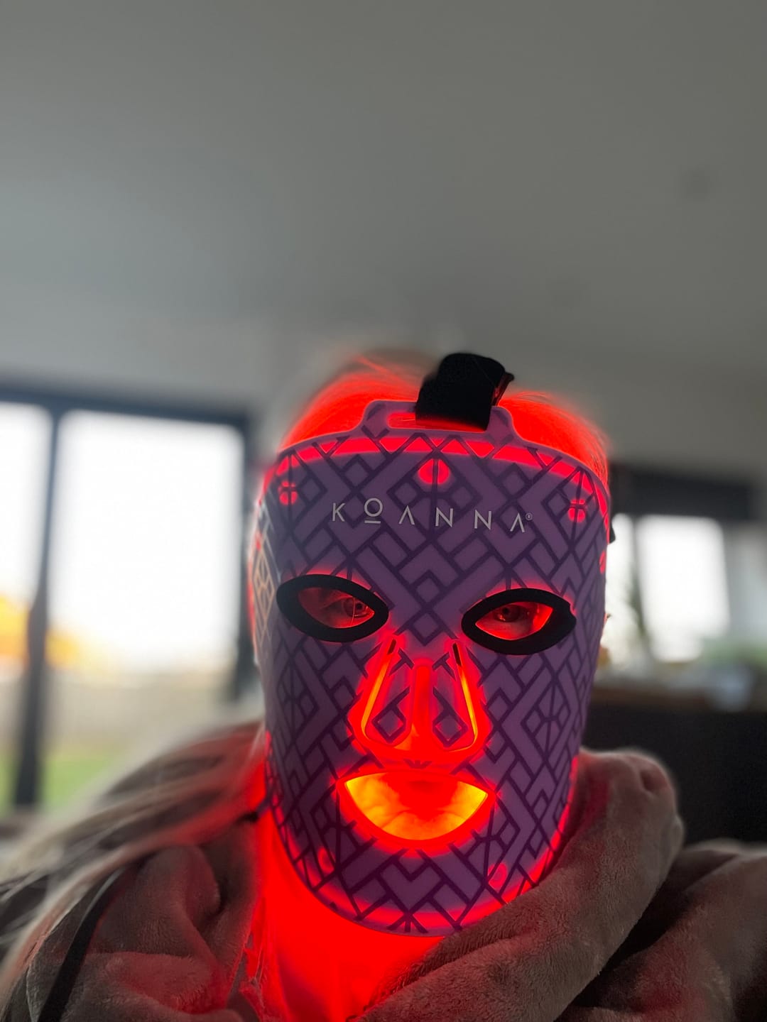 Customer photo review of Koanna® MultiGlo™ LED Light Therapy Mask