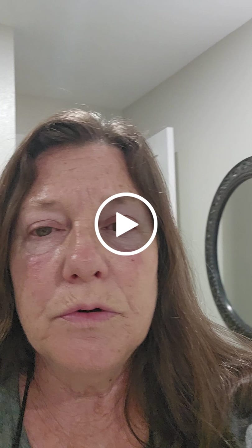 Customer video review of 1 Month Supply - Deep Collagen Cream