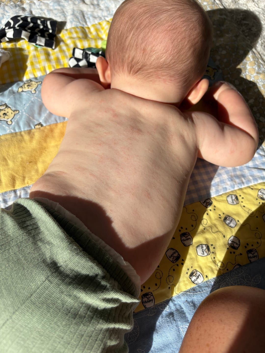 Customer photo review of Baby Cream