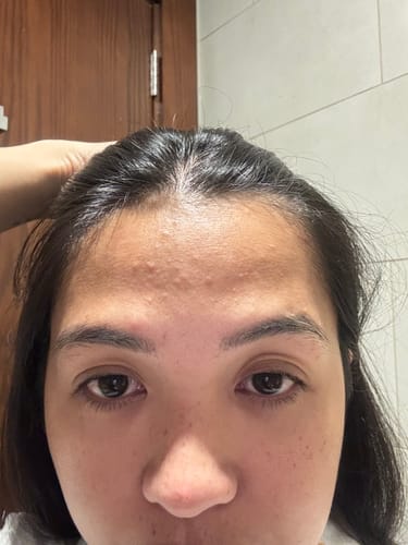 Customer photo review of Haenam404 Peptacica Toner