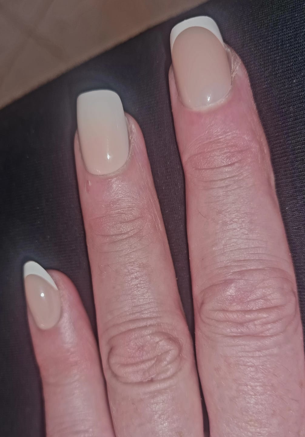 Customer photo review of Starter Set - Nail Veneers