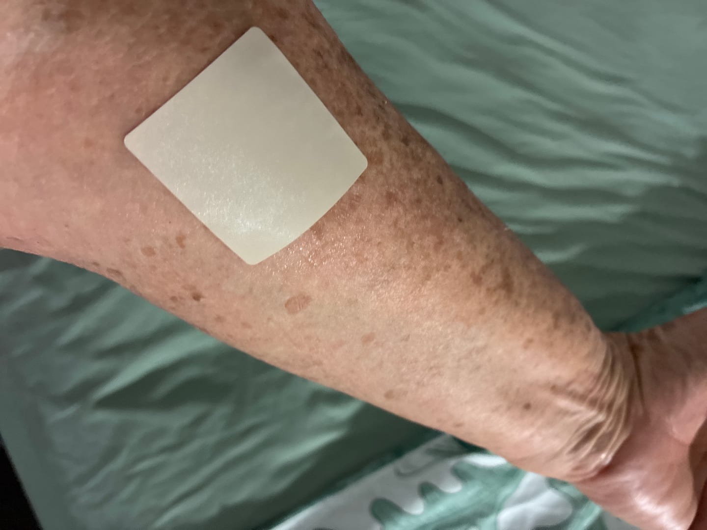 Customer photo review of mussage 8 Hour Sleep Patch