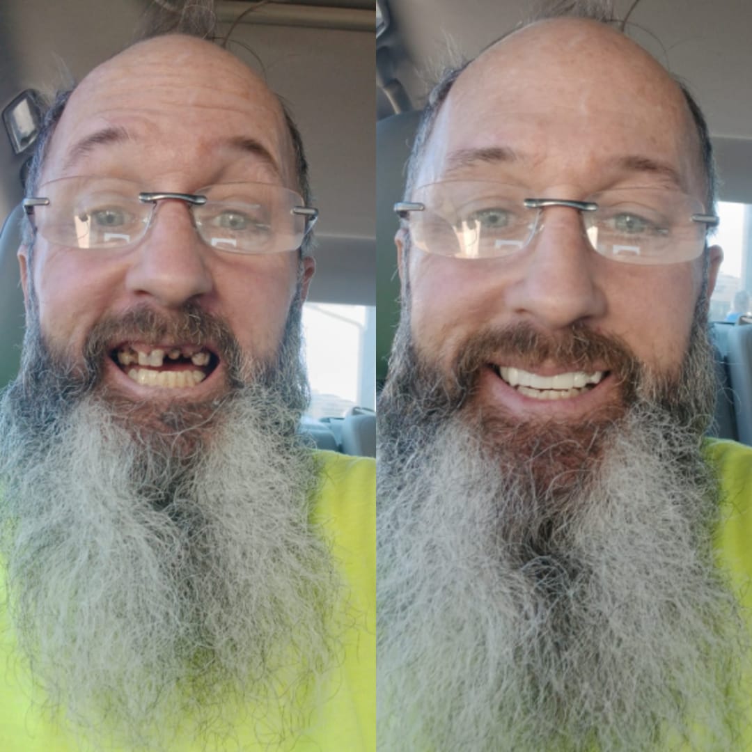 Customer photo review of Faccette-Dentali 3.0