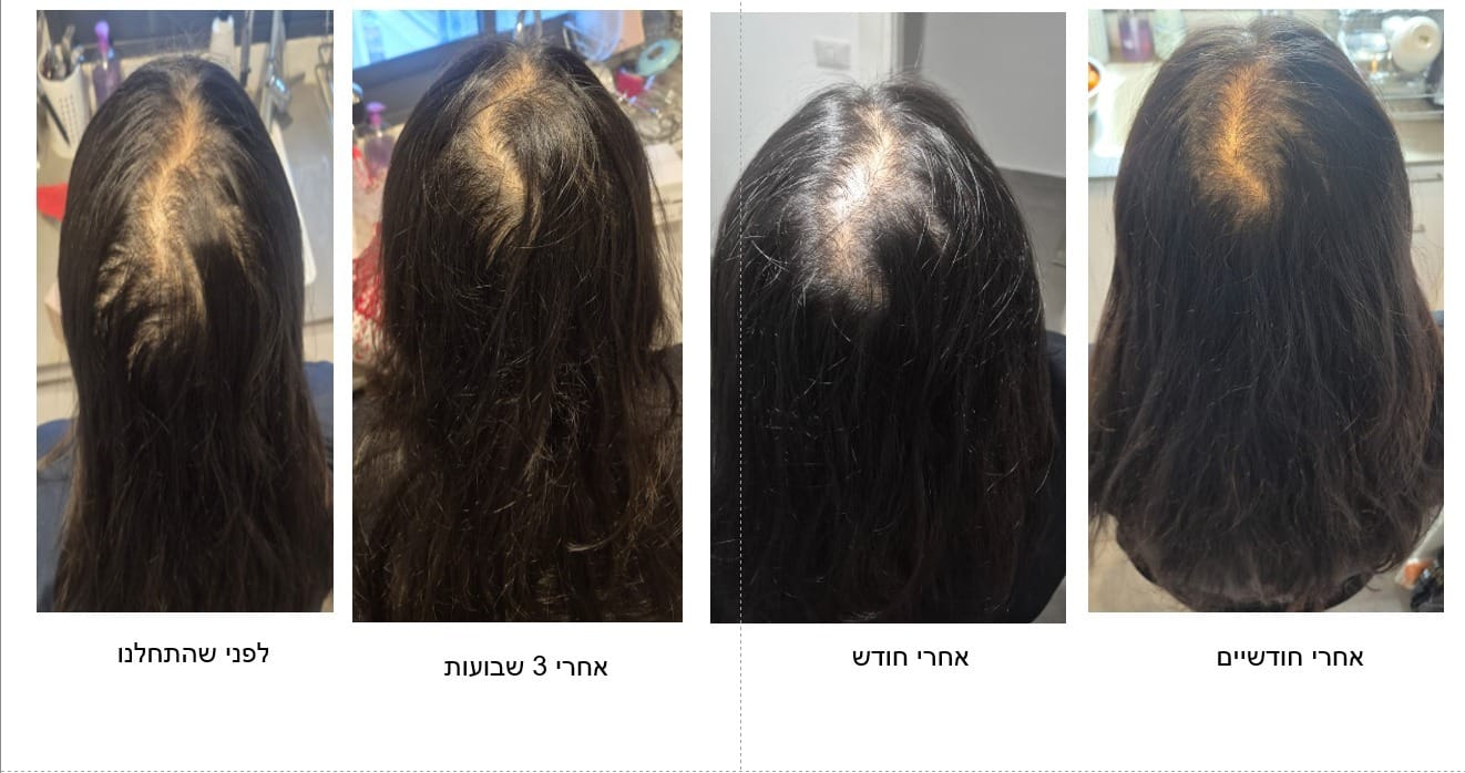 Customer photo review of Fill it women hair complex