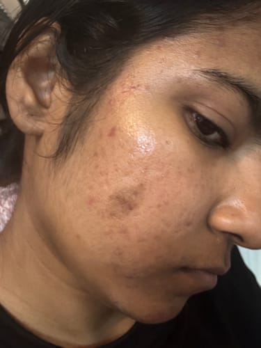 Customer photo review of Korean Collagen Night Wrapping Mask