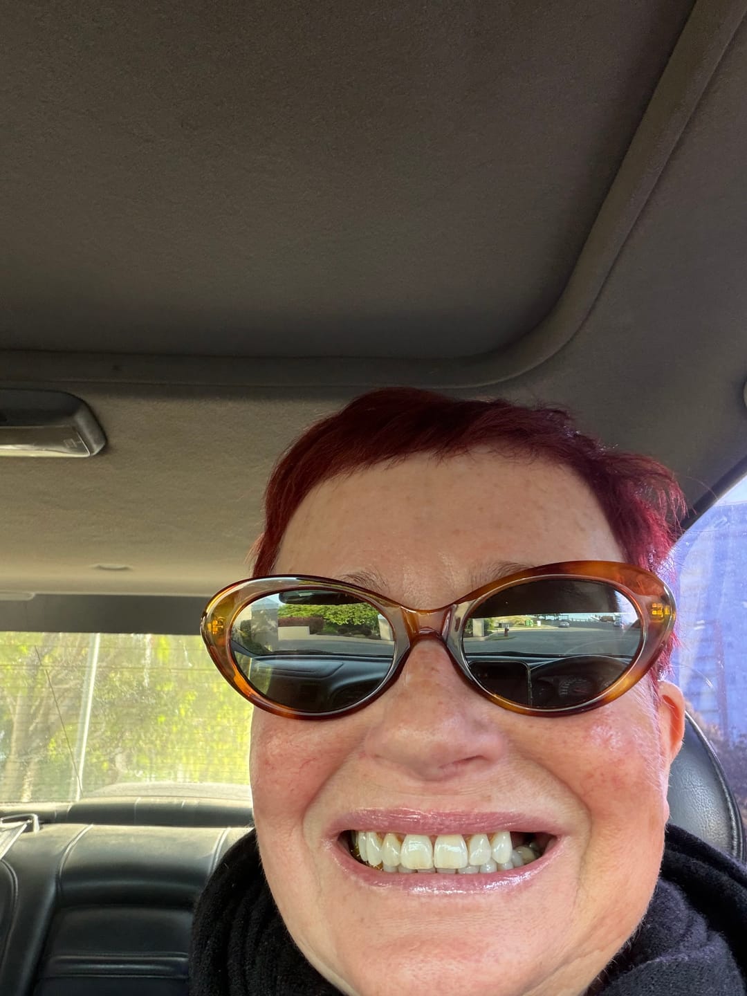 Customer photo review of Koriderm™ Time Reverse Cream (All-In-One)