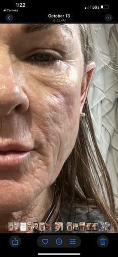 Customer photo review of Korean Collagen Night Wrapping Mask