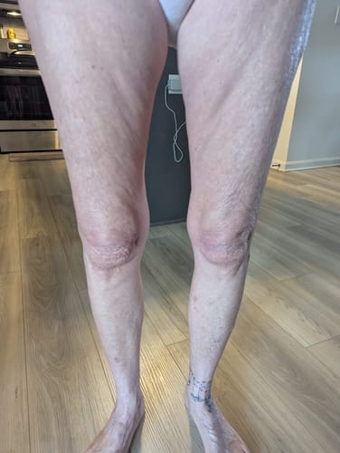 Customer photo review of Magnesium legs butter