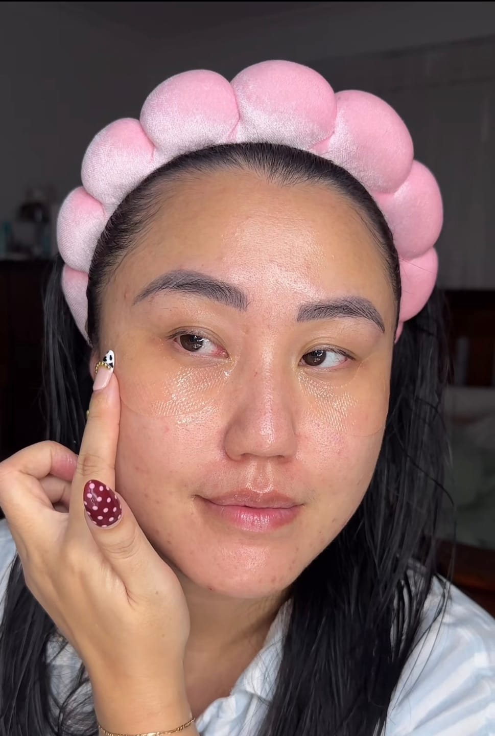 Customer photo review of Glutathione kojic acid eye patch Vita jelly