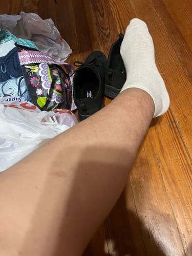Customer photo review of Magnesium legs butter