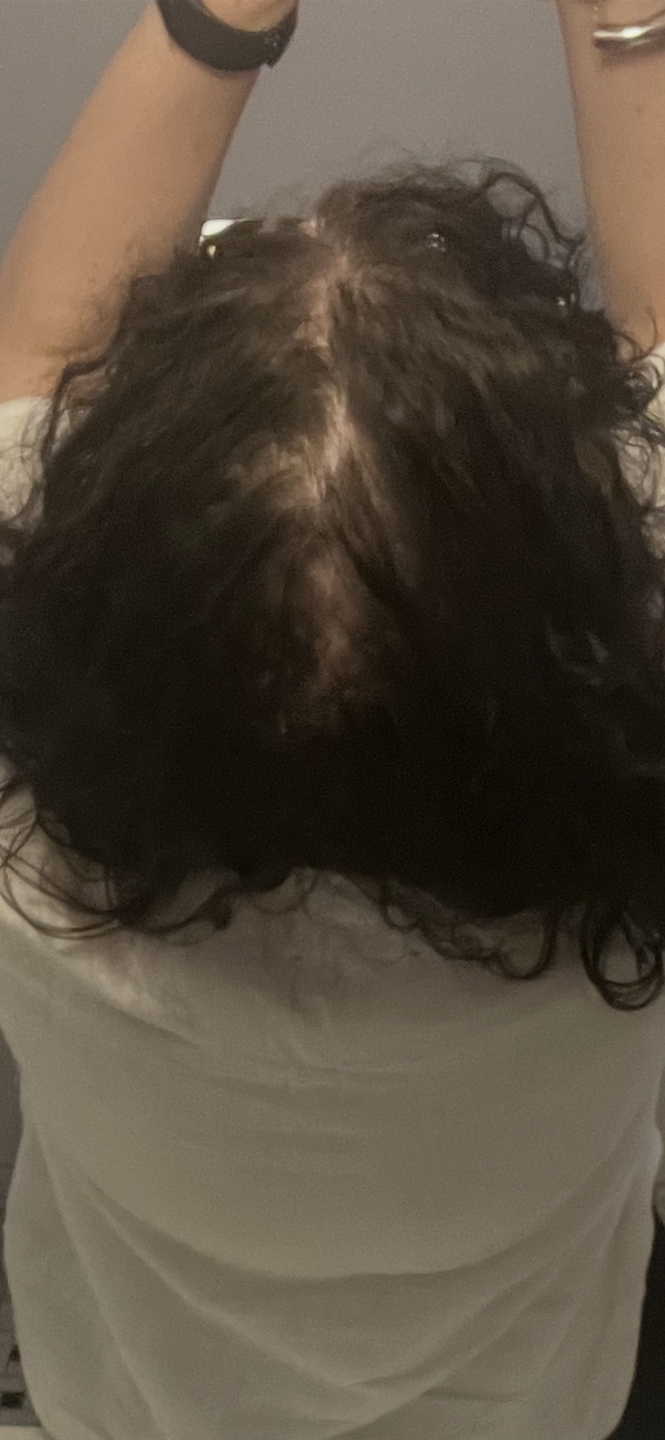 Shona W. before