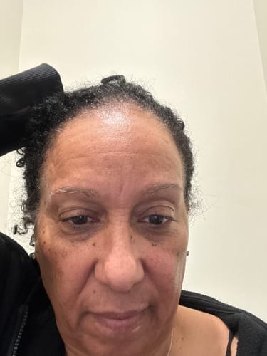 Customer photo review of Korean Collagen Night Wrapping Mask
