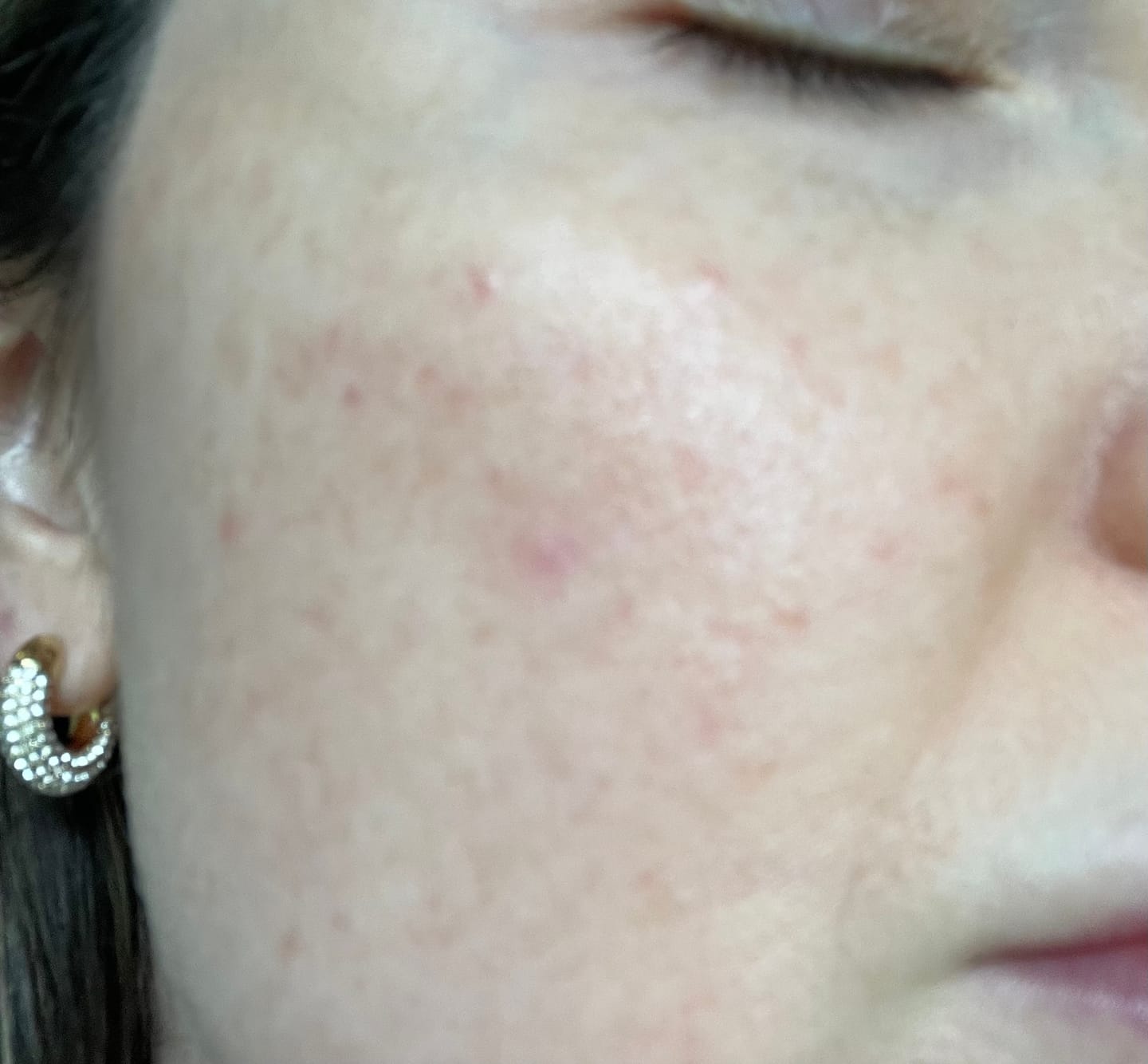 Customer photo review of Protection solaire Face Shield FLEX FPS 50