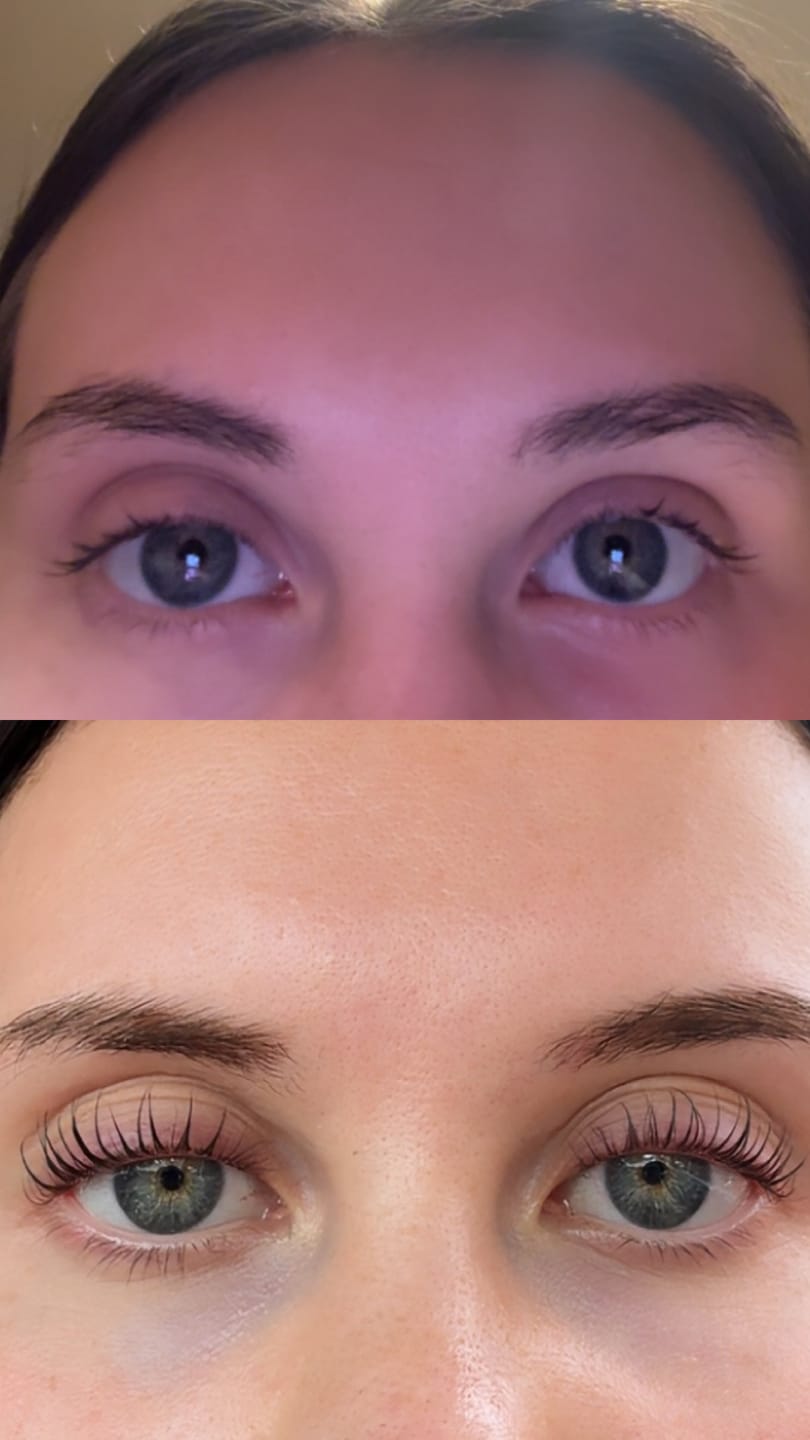 Customer photo review of Lash Growth Serum
