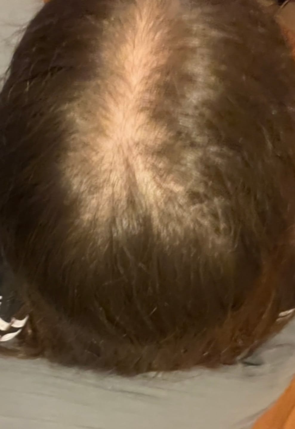 Customer photo review of PEPTIDE-POWERED HAIR SERUM