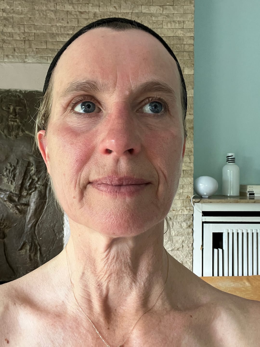 Customer photo review of Natural Botulin Serum