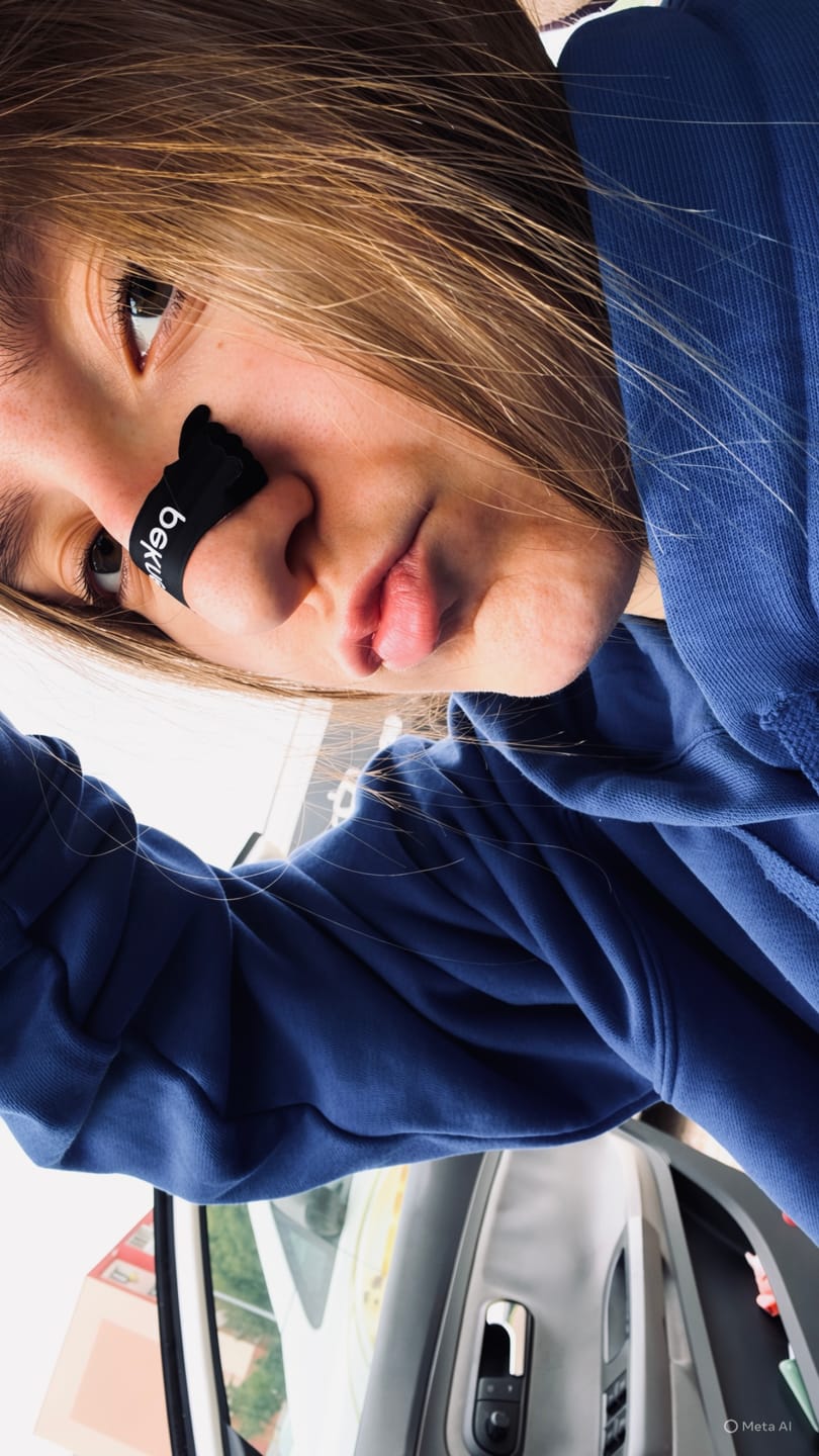 Customer photo review of Pekne™ Strips