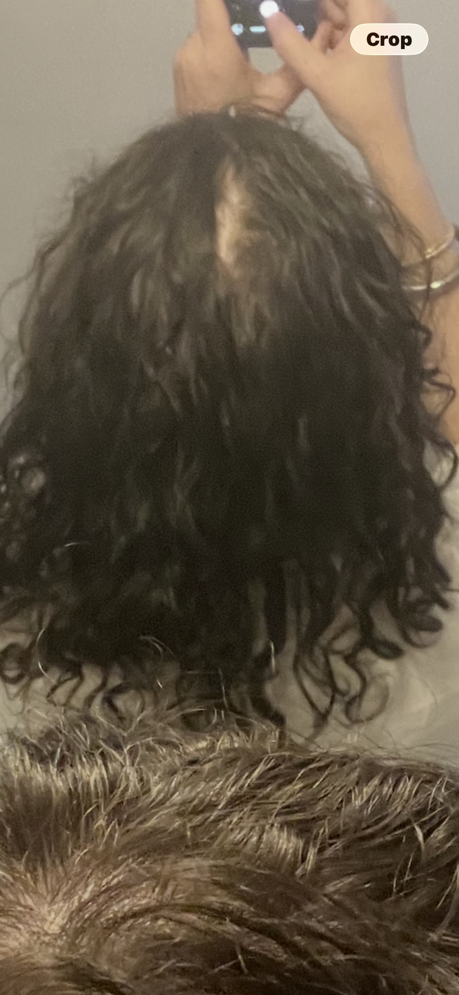 Shona W. after