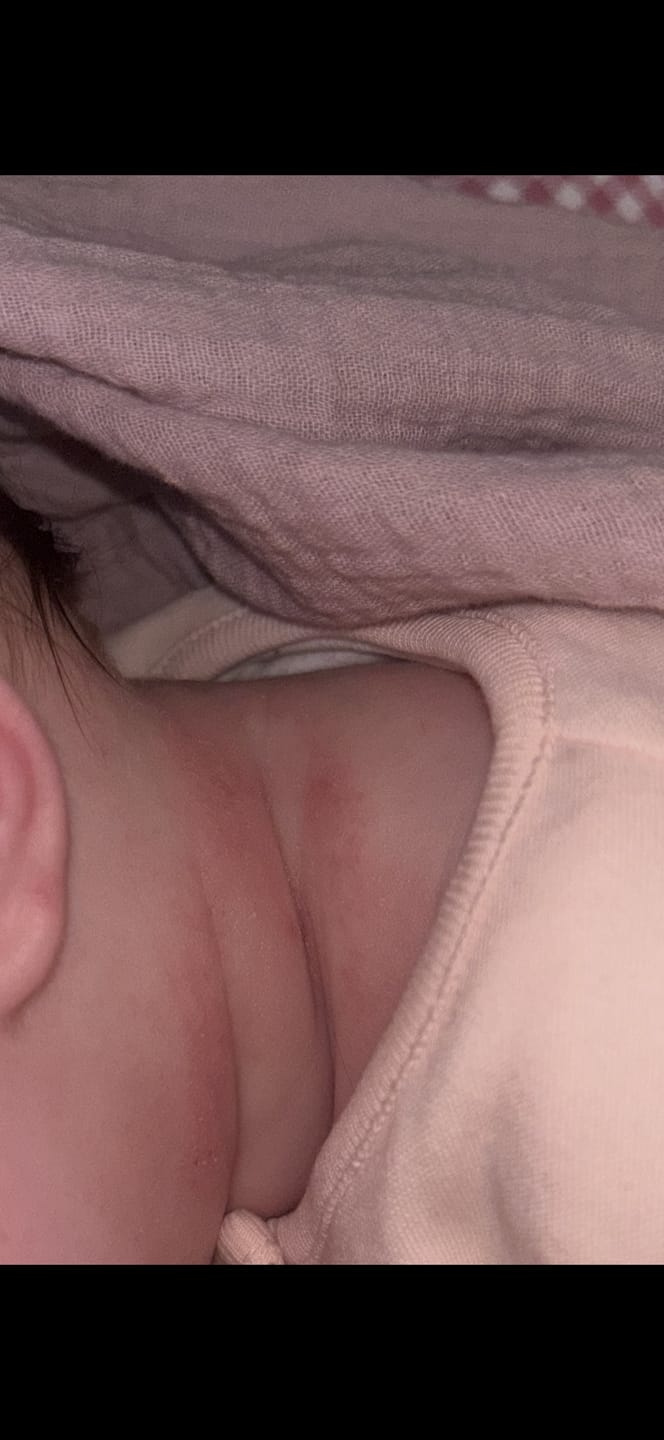 Customer photo review of Grass-Fed Tallow Body Balm | Cold Weather Protection