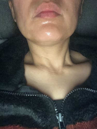 Customer photo review of Korean Collagen Night Wrapping Mask