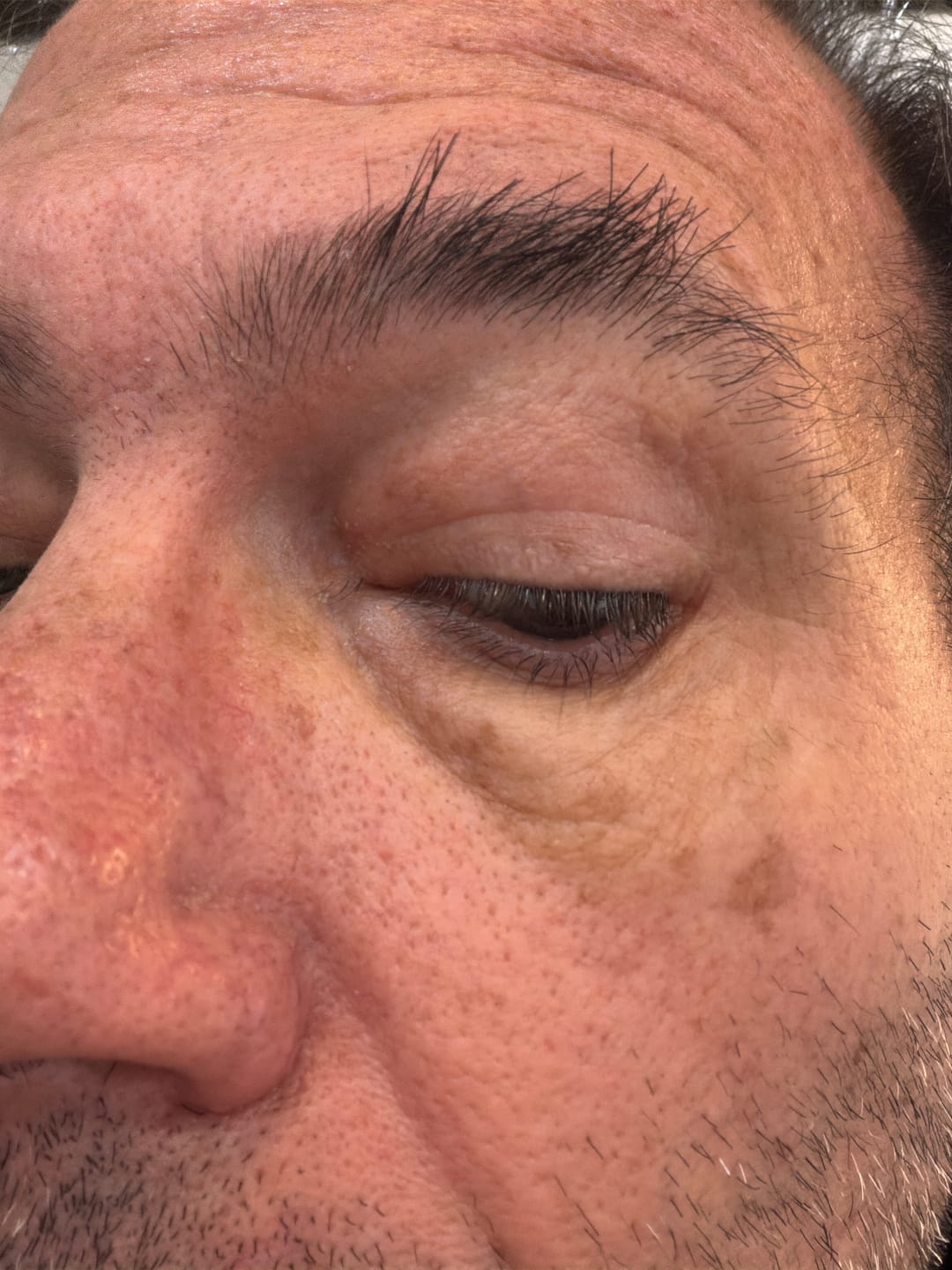 Customer photo review of OMEN Serum anti-edad para Hombre