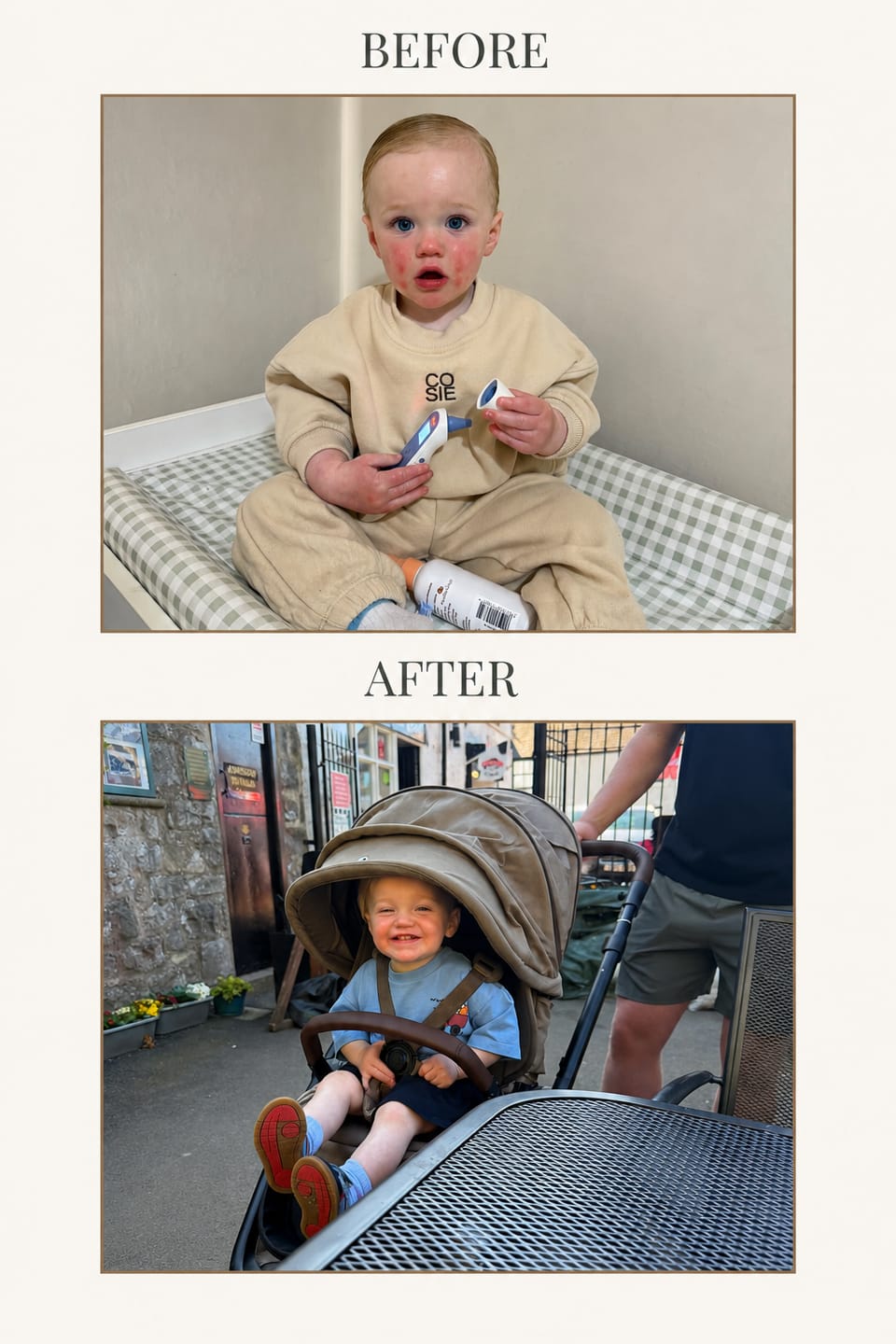 Customer photo review of Calm Skin-Relief Kit