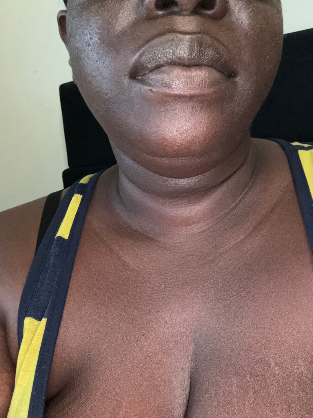 Customer photo review of Brightening Lip Bundle