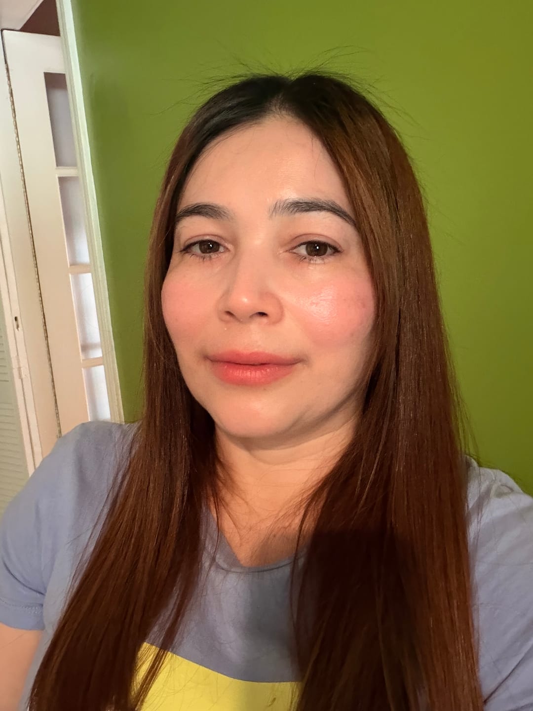 Customer photo review of Serum Ultra Hidratante con 3% de Ácido Hialurónico de LV Champs (30 Ampollas)