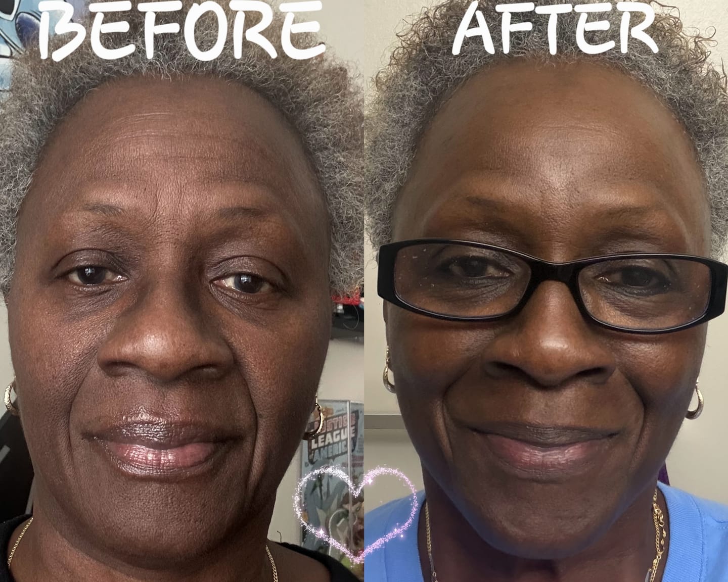 Customer photo review of Brightening Body Oil
