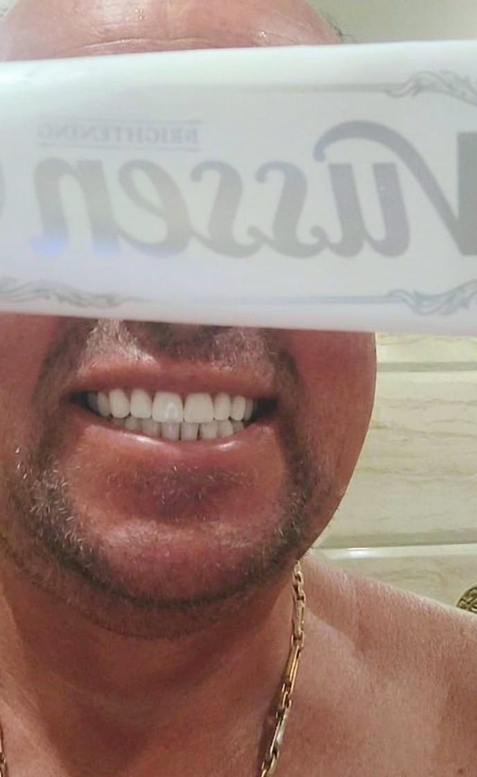 Customer photo review of Избелваща паста за зъби с грижа за емайла с хидроксиапатит 5% Vussen H Toothpaste