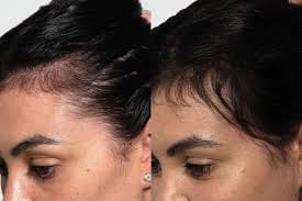 Customer photo review of SIERO PER CAPELLI