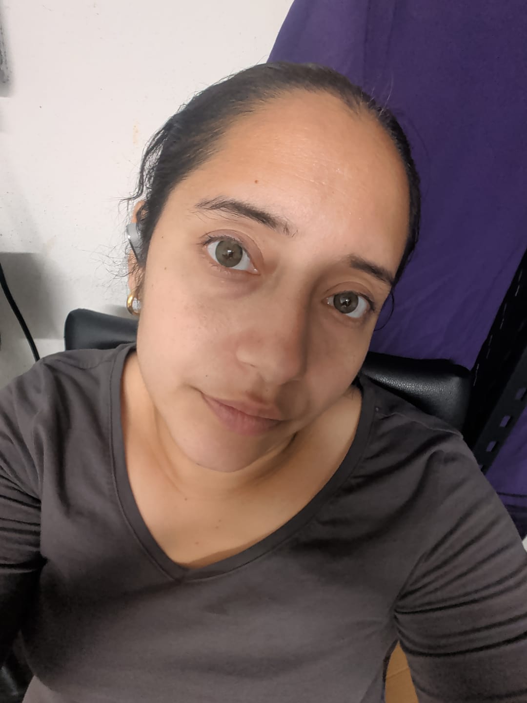Customer photo review of Anita Green Prescription Coloured Contact Lenses