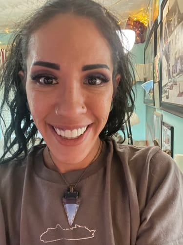Customer's close-up, bright smile showcasing their custom Pop On Veneers.