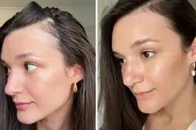 Customer photo review of SIERO PER CAPELLI