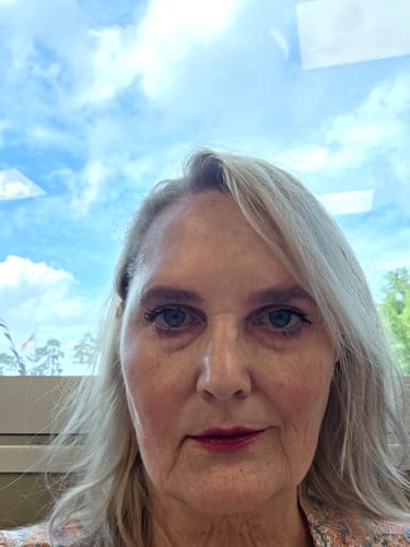 Reviewer showing their face with no makeup after using the Seranova Micro Infusion System.