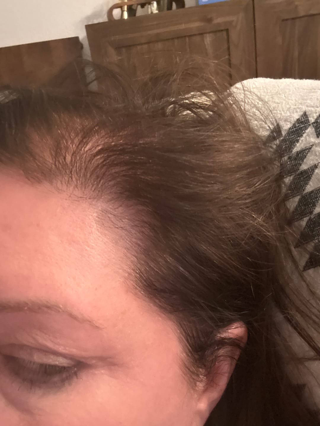 Customer photo review of VITAFOAM ™ Hair Growth Formula