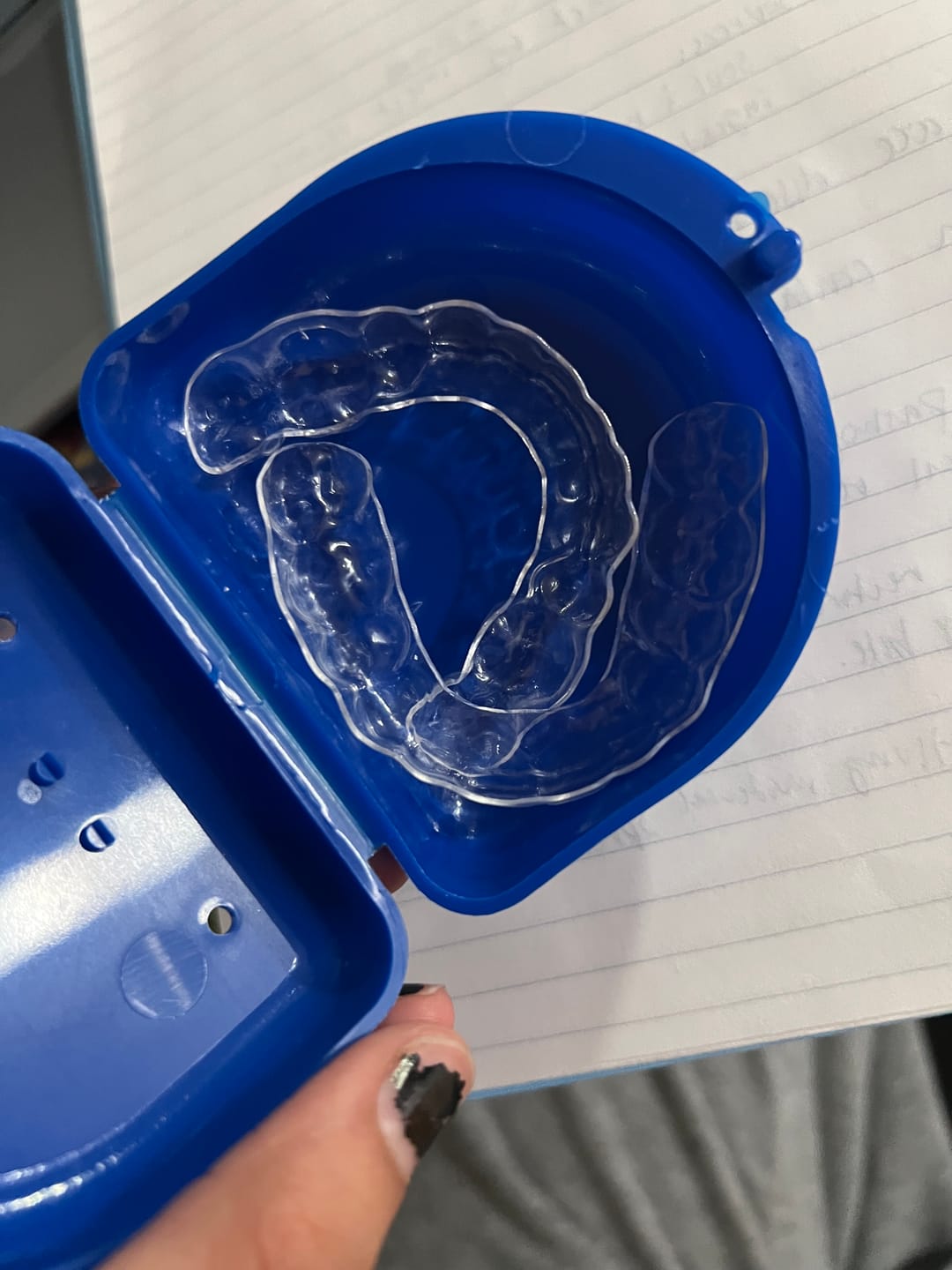 Customer photo review of Upper and Lower Retainers Set