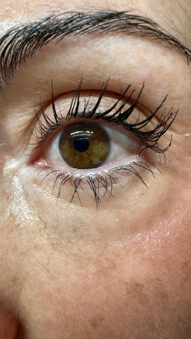 Customer photo review of KosmaLash® | Sérum Crecimiento & Anticaída